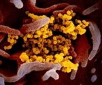 Reducing coronavirus-related mortality through senolytics