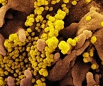 Plasma zinc status not an effective prognostic factor for hospitalized COVID-19 patients