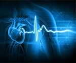 AI ECG as a novel noninvasive approach to diagnosing cardiac injury in COVID-19 patients