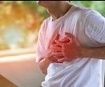 Clinical observations show acute myocarditis developed after mRNA COVID-19 vaccination
