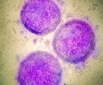 Should we be concerned about the SARS-CoV-2 Lambda variant?