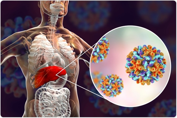 Hepatitis