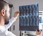New treatment targeting senescent cells boosts functional recovery from spinal cord injury