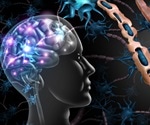Working Towards Earlier Diagnosis of Multiple Sclerosis