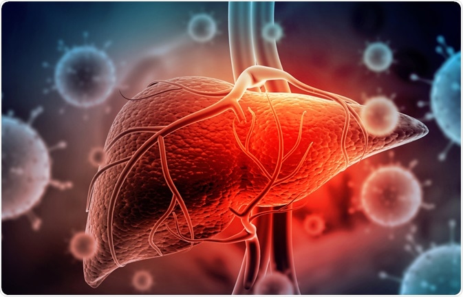 Hepatitis Hepatitis