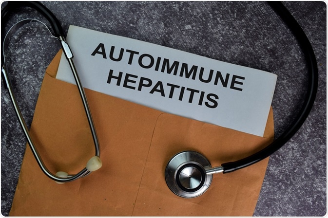 Autoimmune Hepatitis Autoimmune Hepatitis
