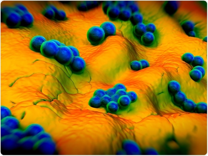 MRSA