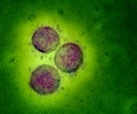 Can molecular mimicry impact fertility in female COVID-19 patients?
