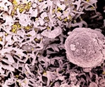 COVID booster shots might be needed in subgroup of HIV-positive individuals