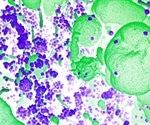 COVID-19 vaccines offer better protection than natural immunity alone