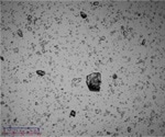 Research into the laser particle size analysis of the Domperidone API