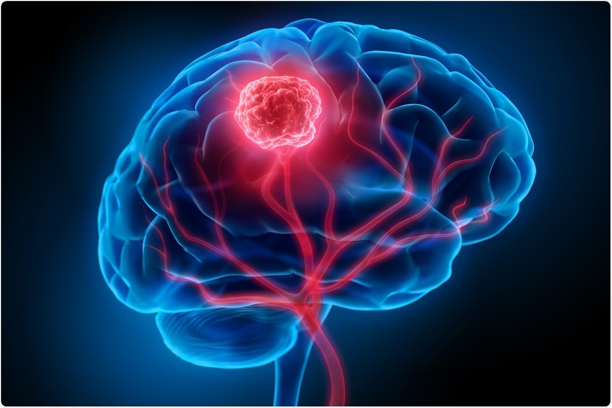 Study: Microengineered perfusable 3D-bioprinted glioblastoma model for in vivo mimicry of tumor microenvironment. Image Credit: peterschreiber.media/ Shutterstock