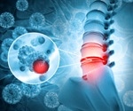 Von Hippel-Lindau Syndrome Screening and Diagnosis