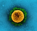 COVID-19 deaths in U.S. surpass 1918 Spanish Flu pandemic
