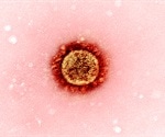 Immune-mediated inflammatory disease may increase risk of severe COVID-19 outcomes