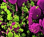 Maternal SARS-CoV-2 vaccination in early-third trimester may optimize neonatal seroprotection