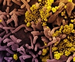 Researchers discover protein previously unknown to be involved in SARS-CoV-2 infection