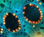 The influence of prior seasonal coronavirus infection on disease severity in COVID-19