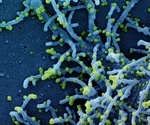 Understanding platelets in COVID-19 may help identify diagnostic markers and treatments