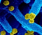 Mu SARS-CoV-2 variant highly resistant to neutralization by convalescent and vaccinated sera