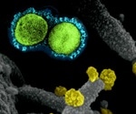 Pfizer-BioNTech’s COVID-19 vaccine appears effective against SARS-CoV-2 mu variant