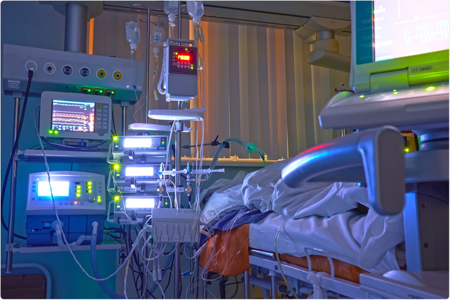Study: The removal of airborne SARS-CoV-2 and other microbial bioaerosols by air filtration on COVID-19 surge units. Image Credit: Kiryl Lis / Shutterstock