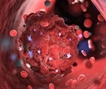 COVID-19 presents a higher risk of blood clots than vaccination