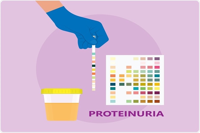 urine sample