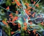 COVID-19 induces the generation of distinct autoantibodies