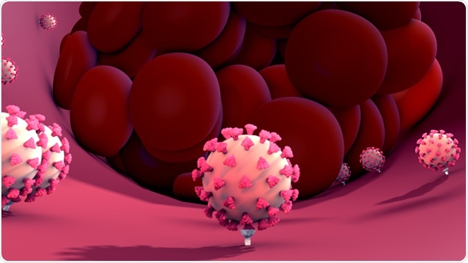 COVID-19 and Blood Clotting