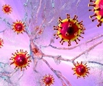 Neuropsychiatric symptoms in children and adolescents with long COVID