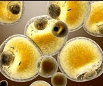 Using Biochemistry to Fight Obesity