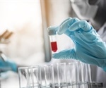 A novel FACS-based approach for SARS-CoV-2 serology