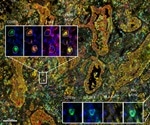 Three critical lab capabilities to look for in immuno-oncology