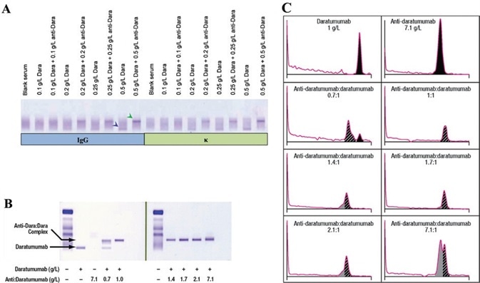 Daratumumab can be identified on IFE/SPE and can be shifted with anti-daratumumab. Daratumumab can be identified on IFE/SPE and can be shifted with anti-daratumumab.