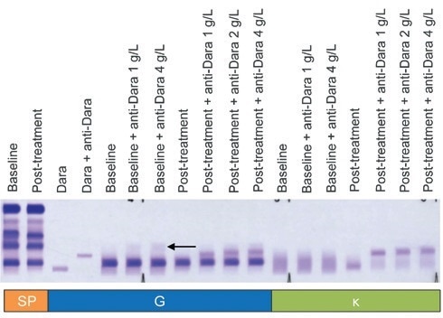 DIRA Plus for the evaluation of patients with serum concentrations of daratumumab above the normal range. DIRA Plus for the evaluation of patients with serum concentrations of daratumumab above the normal range.