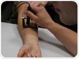 What is trans-epidermal water loss in skin What is trans-epidermal water loss in skin