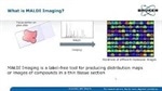MALDI imaging reveals new insight into glycosylation and glycan distributions