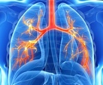 Study suggests myeloid cell dysregulation is a driver of COVID-19 severity