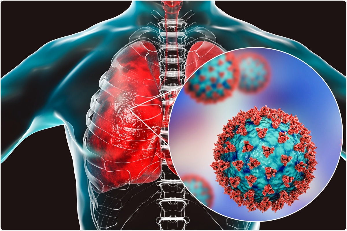 Study: Respiratory epithelial cell responses to SARS-CoV-2 in COVID-19. Image Credit: Kateryna Kon / Shutterstock.com
