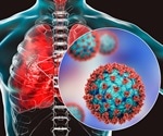 How SARS-CoV-2 infection progresses throughout the respiratory system