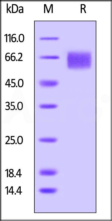 Biotinylated Human IL-6 R alpha, Avitag, His Tag (Cat. No. CD6-H82E8) on SDS-PAGE under reducing (R) condition. The gel was stained overnight with Coomassie Blue. The purity of the protein is greater than 95%. The protein has a calculated MW of 41.7 kDa and migrates as 55-70 kDa due to glycosylation. Biotinylated Human IL-6 R alpha, Avitag, His Tag (Cat. No. CD6-H82E8) on SDS-PAGE under reducing (R) condition. The gel was stained overnight with Coomassie Blue. The purity of the protein is greater than 95%. The protein has a calculated MW of 41.7 kDa and migrates as 55-70 kDa due to glycosylation.