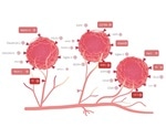 Charting recent advances in PSMA-targeted therapy for prostate cancer