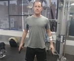 New guidelines outline physical activities that are safe for dialysis patients