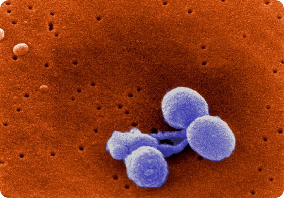 Scanning Electron Micrograph of Streptococcus pneumoniae Scanning Electron Micrograph of Streptococcus pneumoniae
