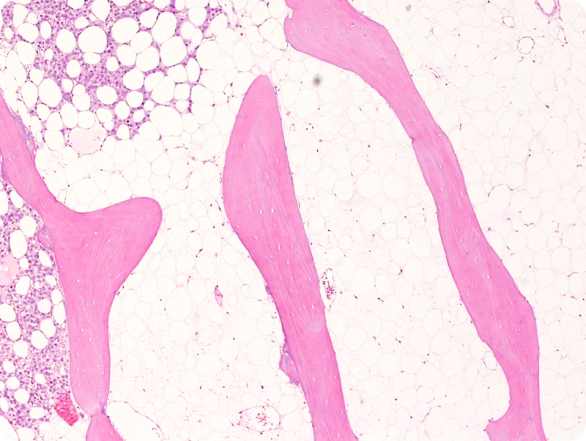 Bone sample