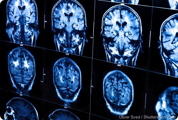 Brain scans