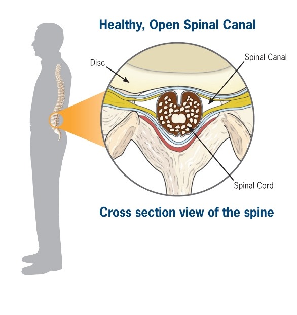 HealthySpineMan