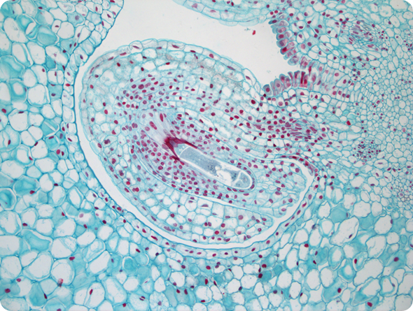 Illium Ilium Brownii (INFINITY3-3UR). 10x Objective, 10 ms Exposure, 1.2x Gain, 1.0 Gamma.