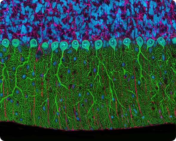 Rat cerebellum